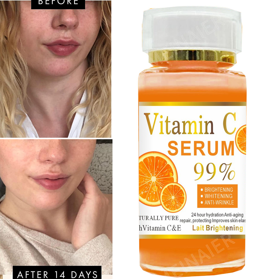 Vitamin C Serum - เซรั่มวิตามินซี120มล. ต่อต้านริ้วรอยเพื่อผิวขาวเซรั่มบำรุงผิวหน้าไร้กาลเวลาเซรั่มต่อต้านริ้วรอยสำหรับจุดด่างดำบนใบหน้า
